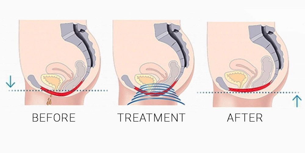 Before & After Treatment