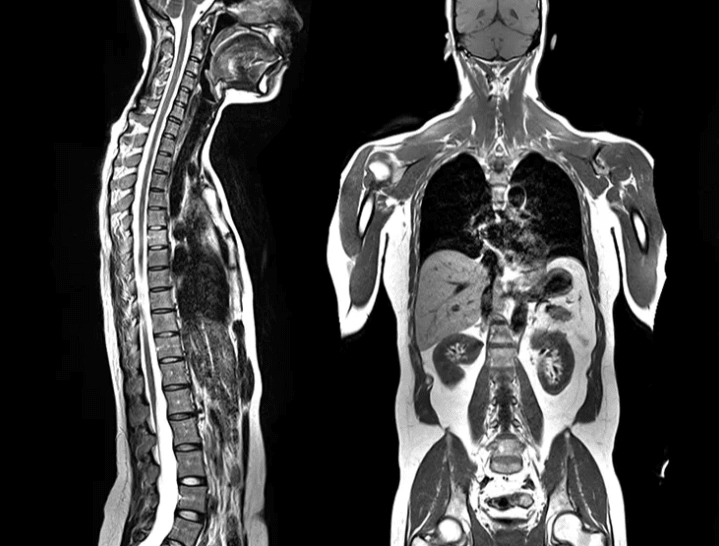 Full-Body MRI